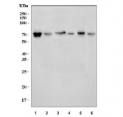 Western blot testing of 1) rat brain, 2) rat kidney, 3) mouse brain, 4) mouse kidney, 5) mouse testis and 6) mouse NIH 3T3 cell lysate with DLAT antibody. Predicted molecular weight ~69 kDa.
