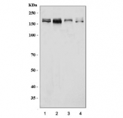 Western blot testing of human 1) HeLa, 2) Caco-2, 3) K562 and 4) ThP-1 cell lysate with EDC4 antibody. Predicted molecular weight ~152 kDa.