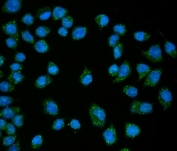 Immunofluorescent staining of FFPE human SiHa cells with EDC4 antibody (green) and DAPI nuclear stain (blue). HIER: steam section in pH6 citrate buffer for 20 min.