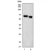 Western blot testing of 1) rat liver and 2) mouse liver tissue lysate with Glucokinase Regulator antibody. Predicted molecular weight ~69 kDa.