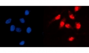 Immunofluorescent staining of FFPE human HeLa cells with Glucokinase Regulator antibody (red) and DAPI nuclear stain (blue). HIER: steam section in pH6 citrate buffer for 20 min.