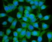 Immunofluorescent staining of FFPE human Caco-2 cells with GGA3 antibody (green) and DAPI nuclear stain (blue). HIER: steam section in pH6 citrate buffer for 20 min.
