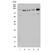 Western blot testing of human 1) SH-SY5Y, 2) HEL, 3) K562, 4) HL60 and 5) T-47D cell lysate with GGA3 antibody. Predicted molecular weight ~78 kDa but can be observed at up to 90 kDa.