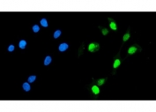 Immunofluorescent staining of FFPE human Caco-2 cells with Geminin antibody (green) and DAPI nuclear stain (blue). HIER: steam section in pH6 citrate buffer for 20 min.