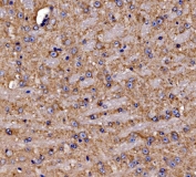 IHC staining of FFPE mouse brain tissue with Gephyrin antibody. HIER: boil tissue sections in pH8 EDTA for 20 min and allow to cool before testing.