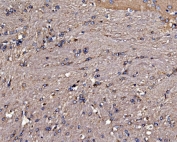 IHC staining of FFPE rat brain tissue with Gephyrin antibody. HIER: boil tissue sections in pH8 EDTA for 20 min and allow to cool before testing.