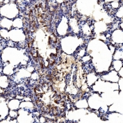 IHC staining of FFPE rat lung tissue with Gephyrin antibody. HIER: boil tissue sections in pH8 EDTA for 20 min and allow to cool before testing.