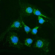 Immunofluorescent staining of FFPE mouse NIH 3T3 cells with Alanine aminotransferase 1 antibody (green) and DAPI nuclear stain (blue). HIER: steam section in pH6 citrate buffer for 20 min.