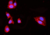 Immunofluorescent staining of FFPE human MCF7 cells with HIP1R antibody (red) and DAPI nuclear stain (blue). HIER: steam section in pH6 citrate buffer for 20 min.