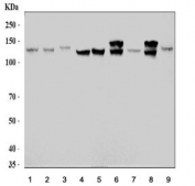 Western blot testing of 1) human HeLa, 2) human PC-3, 3) monkey COS-7, 4) human T-47D, 5) human Raji, 6) rat brain, 7) rat heart, 8) rat pancreas and 9) mouse pancreas lysate with HIP1R antibody. Predicted molecular weight ~119 kDa.
