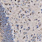 IHC staining of FFPE rat brain tissue with 5HT1B antibody. HIER: boil tissue sections in pH8 EDTA for 20 min and allow to cool before testing.