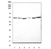 Western blot testing of human 1) A431, 2) HeLa, 3) rat brain, 4) rat C6, 5) mouse brain and 6) mouse Neuro-2a cell lysate with 5HT1B antibody. Predicted molecular weight ~44 kDa.