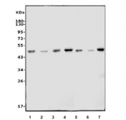 Western blot testing of 1) mouse ANA-1, 2) mouse NIH 3T3, 3) mouse RAW264.7, 4) mouse HEPA-1, 5) rat C6, 6) rat NRK and 7) rat RH35 cell lysate with IL-2 receptor alpha antibody. Expected molecular weight: 25~45 kDa depending on level of glycosylation.