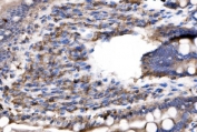 IHC staining of FFPE rat small intestine tissue with IL-2 receptor alpha antibody. HIER: boil tissue sections in pH8 EDTA for 20 min and allow to cool before testing.