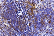 IHC staining of FFPE mouse spleen tissue with IL-2 receptor alpha antibody. HIER: boil tissue sections in pH8 EDTA for 20 min and allow to cool before testing.