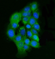 Immunofluorescent staining of FFPE human A431 cells with Integrin Linked Kinase antibody (green) and DAPI nuclear stain (blue). HIER: steam section in pH6 citrate buffer for 20 min.