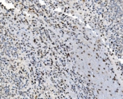 IHC staining of FFPE human spleen tissue with JUNB antibody. HIER: boil tissue sections in pH8 EDTA for 20 min and allow to cool before testing.