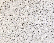 IHC staining of FFPE mouse brain tissue with JUNB antibody. HIER: boil tissue sections in pH8 EDTA for 20 min and allow to cool before testing.