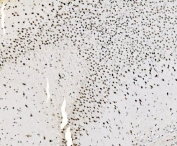 IHC staining of FFPE rat brain tissue with JUNB antibody. HIER: boil tissue sections in pH8 EDTA for 20 min and allow to cool before testing.