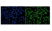 Immunofluorescent staining of FFPE human SiHa cells with JUNB antibody (green) and DAPI nuclear stain (blue). HIER: steam section in pH6 citrate buffer for 20 min.