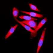 Immunofluorescent staining of FFPE human PC-3 cells with KLC1 antibody (red) and DAPI nuclear stain (blue). HIER: steam section in pH6 citrate buffer for 20 min.