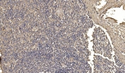 IHC staining of FFPE human spleen tissue with ASK1 antibody. HIER: boil tissue sections in pH8 EDTA for 20 min and allow to cool before testing.