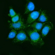 Immunofluorescent staining of FFPE human MCF7 cells with ASK1 antibody (green) and DAPI nuclear stain (blue). HIER: steam section in pH6 citrate buffer for 20 min.