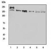 Western blot testing of 1) human RT4, 2) human HEL, 3) human HL60, 4) human ThP-1, 5) rat liver and 6) mouse liver lysate with ASK1 antibody. Predicted molecular weight ~155 kDa.