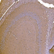 IHC staining of FFPE rat brain tissue with P2X7 antibody. HIER: boil tissue sections in pH8 EDTA for 20 min and allow to cool before testing.