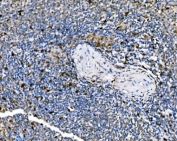 IHC staining of FFPE human spleen tissue with PAK1 antibody. HIER: boil tissue sections in pH8 EDTA for 20 min and allow to cool before testing.