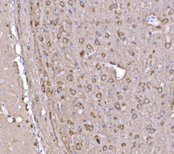 IHC staining of FFPE rat brain tissue with PAK1 antibody. HIER: boil tissue sections in pH8 EDTA for 20 min and allow to cool before testing.