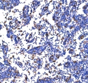 IHC staining of FFPE mouse lymph node tissue with PAK1 antibody. HIER: boil tissue sections in pH8 EDTA for 20 min and allow to cool before testing.