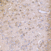 IHC staining of FFPE mouse brain tissue with PAK1 antibody. HIER: boil tissue sections in pH8 EDTA for 20 min and allow to cool before testing.