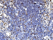 IHC staining of FFPE rat lymph node tissue with PAK1 antibody. HIER: boil tissue sections in pH8 EDTA for 20 min and allow to cool before testing.