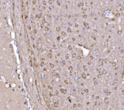 IHC staining of FFPE rat brain tissue with PAK1 antibody. HIER: boil tissue sections in pH8 EDTA for 20 min and allow to cool before testing.