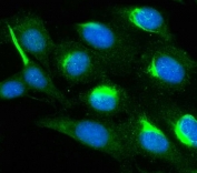 Immunofluorescent staining of FFPE human U-2 OS cells with PAK1 antibody (green) and DAPI nuclear stain (blue). HIER: steam section in pH6 citrate buffer for 20 min.