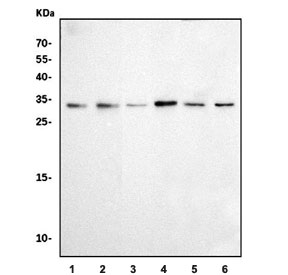 Western blot testing of 1) human HepG2, 2) human Jurkat, 3) human MCF7, 4) human PC-3, 5) rat brain and 6) rat testis tissue lysate with RPL8 antibody. Predicted molecular weight: ~28 kDa.