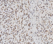 IHC staining of FFPE mouse brain tissue with RPL10 antibody. HIER: boil tissue sections in pH8 EDTA for 20 min and allow to cool before testing.