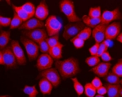 Immunofluorescent staining of FFPE human MCF7 cells with RPL10 antibody (red) and DAPI nuclear stain (blue). HIER: steam section in pH6 citrate buffer for 20 min.