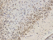 IHC staining of FFPE rat brain tissue with RPL10 antibody. HIER: boil tissue sections in pH8 EDTA for 20 min and allow to cool before testing.