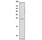 Western blot testing of human HeLa cell lysate with RPL10 antibody. Predicted molecular weight ~25 kDa.