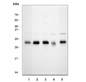 Western blot testing of 1) human HeLa, 2) human K562, 3) human HEK293, 4) rat C6 and 5) mouse NIH 3T3 cell lysate with RPL10 antibody. Predicted molecular weight ~25 kDa.
