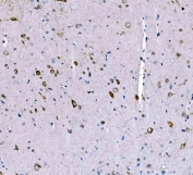 IHC staining of FFPE rat brain tissue with SCRN1 antibody. HIER: boil tissue sections in pH8 EDTA for 20 min and allow to cool before testing.