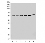 Western blot testing of 1) human HepG2, 2) human PC-3, 3) human HEK293, 4) rat brain, 5) mouse brain and 6) mouse testis tissue lysate with SCRN1 antibody. Predicted molecular weight ~50 kDa.