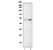 Western blot testing of 1) rat C6 and 2) mouse SP2/0 cell lysate with Sox11 antibody. Predicted molecular weight ~47 kDa.