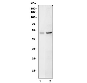 Western blot testing of 1) rat C6 and 2) mouse SP2/0 cell lysate with Sox11 antibody. Predicted molecular weight ~47 kDa.