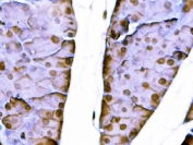 IHC staining of FFPE mouse pancreas tissue with Sox11 antibody. HIER: boil tissue sections in pH8 EDTA for 20 min and allow to cool before testing.