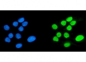 Immunofluorescent staining of FFPE human HepG2 cells with SPHK1 antibody (green) and DAPI nuclear stain (blue). HIER: steam section in pH6 citrate buffer for 20 min.