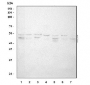 Western blot testing of human 1) HepG2, 2) MCF7, 3) A431, 4) PC-3, 5) HeLa, 6) U-2 OS and 7) Caco-2 cell lysate with SPHK1 antibody. Expected molecular weight: 43-51 kDa (multiple isoforms).