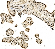 IHC staining of FFPE human placental tissue with SPHK1 antibody. HIER: boil tissue sections in pH8 EDTA for 20 min and allow to cool before testing.